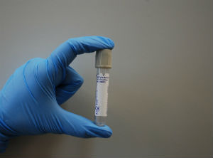 Uruguayan researchers obtain patent under PCT