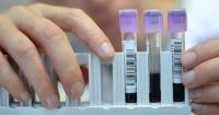 Milestone Framework Against Doping